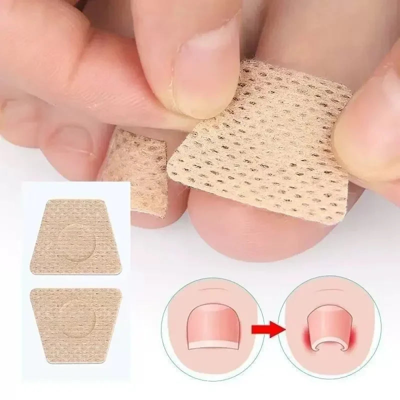 Toenail Fungus Patch Nail Repair Patches Nail Ingrown Correction
